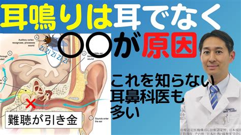 fateopen 耳鳴|耳鼻科医師が解説。耳鳴りがキーンと聞こえる原因は『難聴の脳。